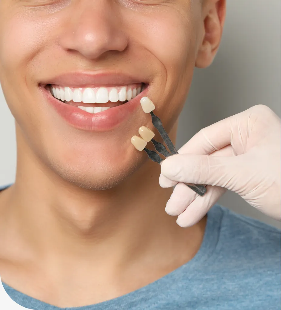 Composite veneer application at Indian Trace Dental in Weston