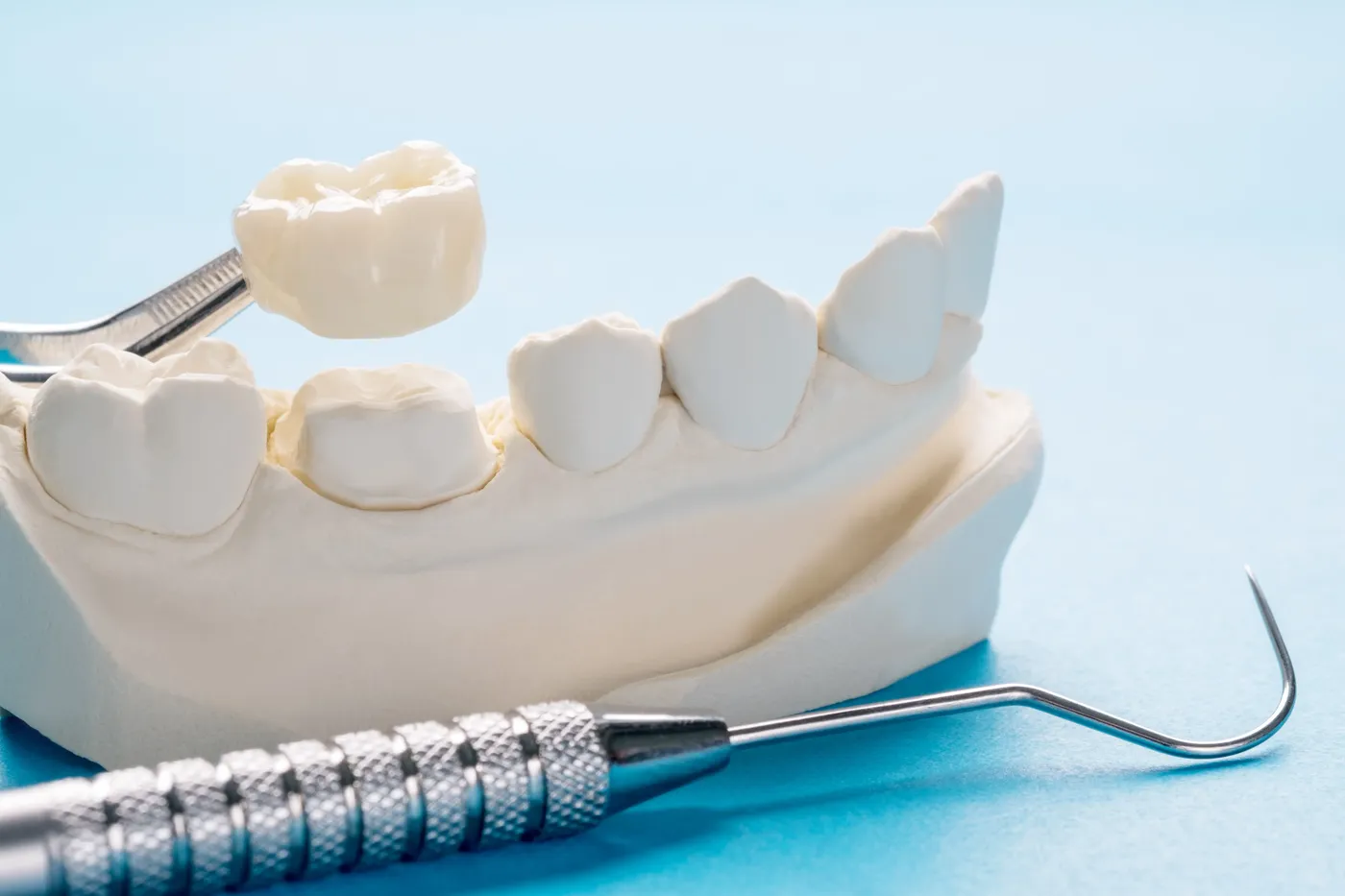 Patient receiving a dental crown at Indian Trace Dental