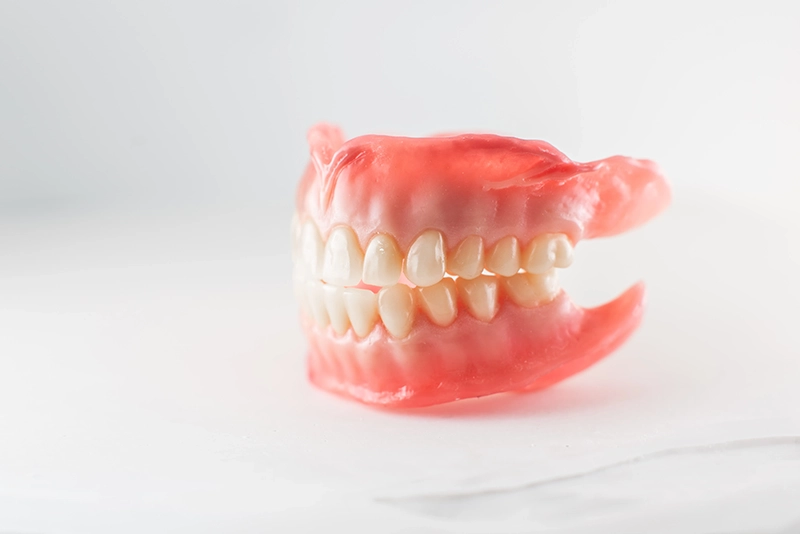 Custom removable denture prosthesis at Indian Trace Dental